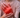 PRP nach Bandscheibenvorfall – stabilisierend?