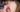 PRP nach Permanent Make-up – hilfreich?