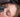 PRP nach Permanent Make-up – hilfreich?