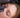 PRP nach Permanent Make-up – hilfreich?