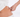 PRP oder Eigenfett – was wirkt besser?