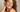 Secret RF oder Microneedling – was ist besser?