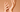 PRP bei Nagelproblemen?