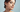 Wie unterstützt PRP die Heilung nach einem Facelift?