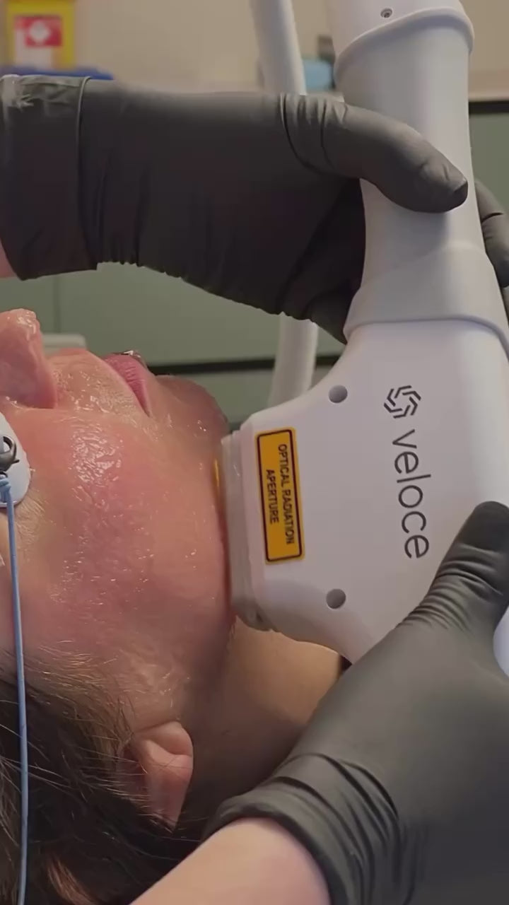 VELOCE BBL Image Viddeo